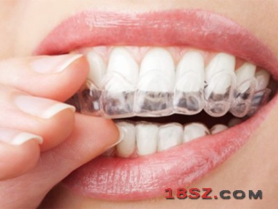 深圳定制式牙齿隐形正畸矫治器-3D隐形矫正-隐形牙套矫治